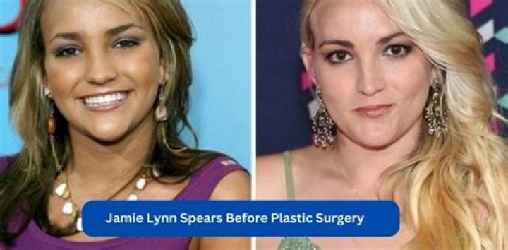 Jamie-Lynn Sigler Plastic Surgery Before and After