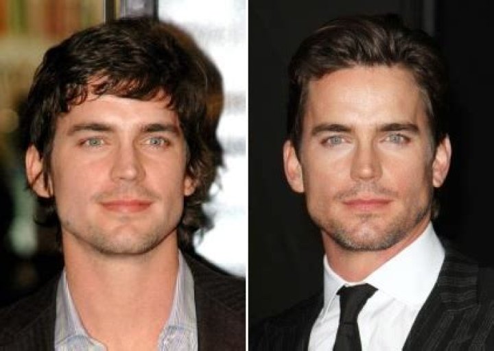 Matt Bomer Plastic Surgery Before and After